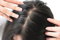 Lý do không ngờ khiến da đầu có mùi hôi