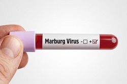 Chủ động phòng bệnh Marburg
