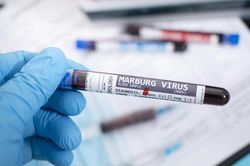 Nâng cao cảnh giác với virus Marburg vì chưa có vaccine phòng, tỷ lệ tử vong cao
