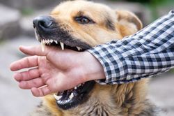 Bé trai ở Cà Mau bị chó dại cắn rách mặt