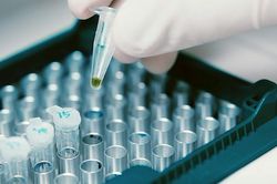 Virus lạ khiến 3 người tử vong trong vòng 24 giờ
