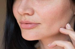 Bí quyết chăm sóc da hỗn hợp chuẩn nhất