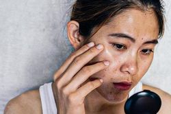 6 tác hại khi không thoa kem chống nắng đều đặn
