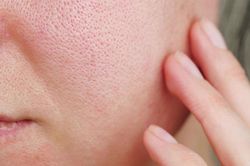Cách làm mặt nạ thu nhỏ lỗ chân lông
