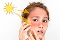 Sai lầm nghiêm trọng trong mùa Hè gây hỏng da