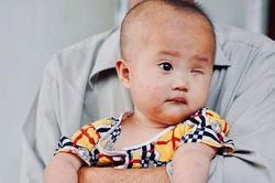 Lời khẩn cầu của ông nội xin cứu bé gái 14 tháng tuổi phải bỏ một bên mắt vì ung thư