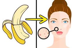 8 tác dụng làm đẹp bất ngờ từ vỏ chuối khiến chị em mắt tròn, mắt dẹt