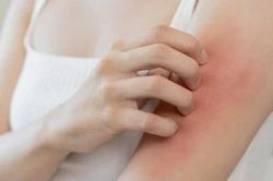 Dấu hiệu '2 ngứa 1 đen' trên cơ thể cảnh báo ung thư gan đang đứng 'gõ cửa' nhà bạn