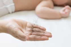 Cách giảm rụng tóc sau sinh