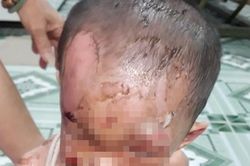 Nghi vấn bé trai ở TPHCM bị cha mẹ đánh đập dã man, trên người đầy vết thương