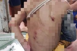 Công an khẩn trương vào cuộc làm rõ vụ bé trai có nhiều vết thương trên người