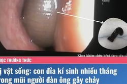 Đỉa sống trong mũi hơn 3 tháng, được chẩn đoán viêm xoang, uống kháng sinh kéo dài
