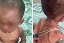 Thông tin mới nhất vụ 'Bé trai cơ thể đầy thương tích, nghi bị bạo hành'