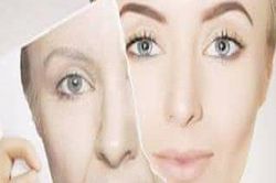 4 cách ngăn ngừa da lão hóa sớm