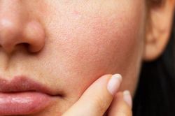 Bí quyết giúp bạn thu nhỏ lỗ chân lông tại nhà