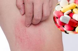 Điều gì sẽ xảy ra nếu bạn bị ốm và tự ra hiệu thuốc mua kháng sinh về uống?