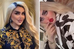 Phẫu thuật 43 lần vì muốn giống búp bê Barbie, cô gái nhận về cái kết đắng
