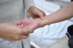 Dấu hiệu nhận biết trẻ bị sốt xuất huyết