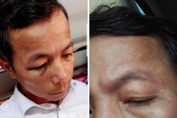 Vụ hiệu trưởng đánh hiệu phó ở Quảng Bình: Cả hai cùng bị phạt tiền