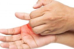Nguyên nhân và cách hạn chế tê ngứa ran cánh tay