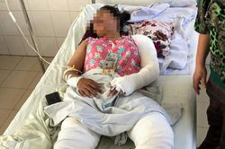 Mẹ kế tẩm xăng đốt cả nhà, 4 người bị thương