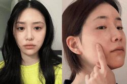 Bác sĩ chỉ ra 5 lỗi skincare phổ biến khiến da lão hóa 'không phanh'
