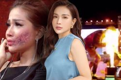 Khi sao Việt bị lửa bắn vào người: Khả Như phải nhập viện, hai người còn lại thế nào?
