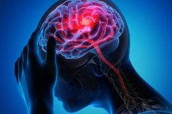 Cảnh báo nguy hiểm khi uống An cung thường xuyên phòng đột quỵ não