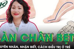 Bàn chân bẹt: Dị tật phổ biến nhưng ít người quan tâm