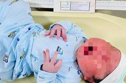 Bé trai vừa chào đời đã nặng 5,6kg