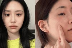Bác sĩ chỉ ra 5 lỗi skincare phổ biến khiến da lão hóa 'không phanh'