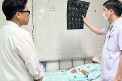 Người phụ nữ mang khối u vùng mặt to như chiếc đầu thứ hai