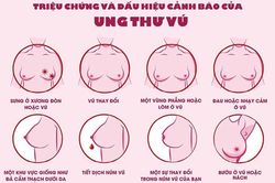 Ngoài 20 tuổi đã mắc ung thư vú
