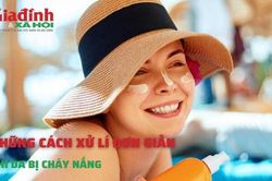 Những cách xử lí đơn giản khi da bị cháy nắng