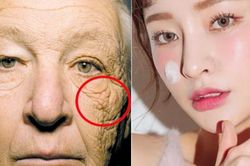Hình ảnh cho thấy vì sao phải bôi kem chống nắng đều đặn mỗi ngày