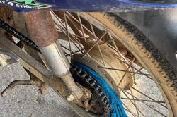 Áo chống nắng cuốn vào bánh xe máy, cháu bé bị ngã gãy tay
