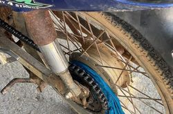 Áo khoác nắng cuốn vào bánh xe, cháu bé bị tai nạn gãy tay.