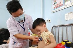 Bệnh Tay chân miệng gia tăng: Bộ Y tế có công văn khẩn