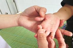 Quảng Nam yêu cầu sẵn sàng các đội cơ động điều trị bệnh tay chân miệng