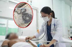 Truyền 10 lọ huyết thanh cứu sống bệnh nhân bị rắn hổ chúa cắn