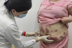 TP Hồ Chí Minh kiên quyết xử lý dịch vụ thẩm mỹ 'chui'