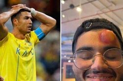 Thực hư về anh chàng đen đủi bị Cristiano Ronaldo đá bươu trán gây xôn xao MXH