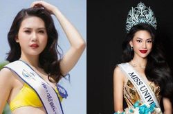 Chuyên gia nội khoa nghi ngờ Bùi Quỳnh Hoa căng chỉ mắt, tiêm filler để thi hoa hậu