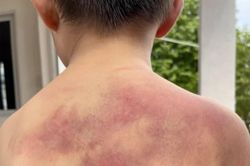 Người cha đánh đập con trai tàn nhẫn vì 'không học bài'