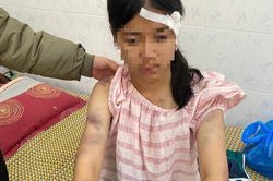 Hội Bảo vệ Quyền trẻ em yêu cầu xử lý nghiêm vụ bé gái 13 tuổi bị người thân tra tấn ở Thái Nguyên