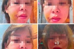 Người phụ nữ cầu cứu sau nhiều lần bị chồng hành hung