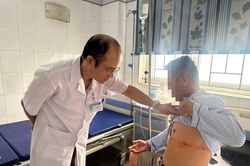 Chủ quan với zona thần kinh, người đàn ông 43 tuổi nhập viện vì tổn thương da lan rộng