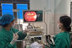 Người đàn ông nuốt tăm xỉa răng đâm xuyên tá tràng