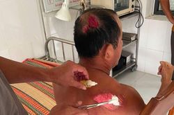 Ngư d&acirc;n c&acirc;m điếc bị t&agrave;u lạ t&ocirc;ng ch&igrave;m thuyền rồi bỏ mặc giữa biển