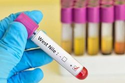 WHO cảnh báo tăng ca nhiễm virus Tây sông Nile ở châu Âu